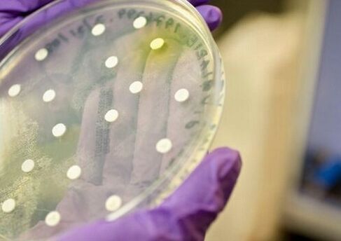 cultura bacteriana pentru diagnosticul prostatitei